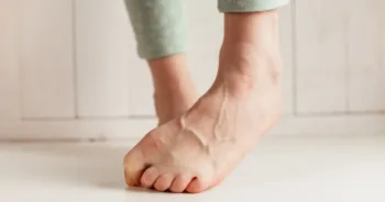 Women's tired ankles with clasped fingers and bulging veins close-up on a light background