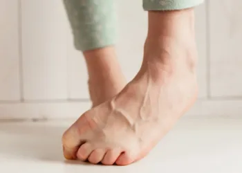 Women's tired ankles with clasped fingers and bulging veins close-up on a light background