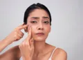 pngtree-a-young-woman-popping-a-pimple-on-her-face-photo-image_2174046