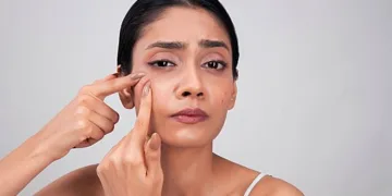 pngtree-a-young-woman-popping-a-pimple-on-her-face-photo-image_2174046