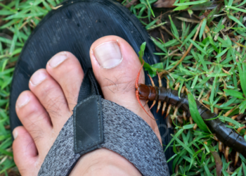 pngtree-some-individuals-experienced-centipede-bites-on-their-feet-photo-picture-image_9580423