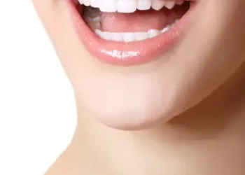 Veneers-1