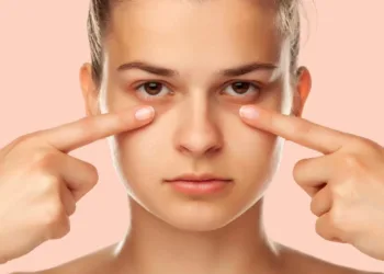 eyes-dark-circles