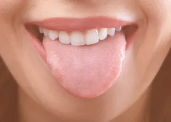 GSD-Scalloped-Tongue-Causes-and-Treatment-Blog-01