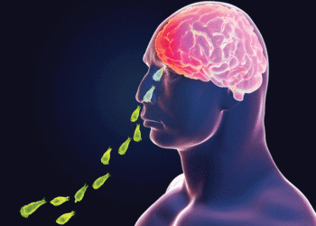 2369422-ameobic-meningo-encephalitis-29824