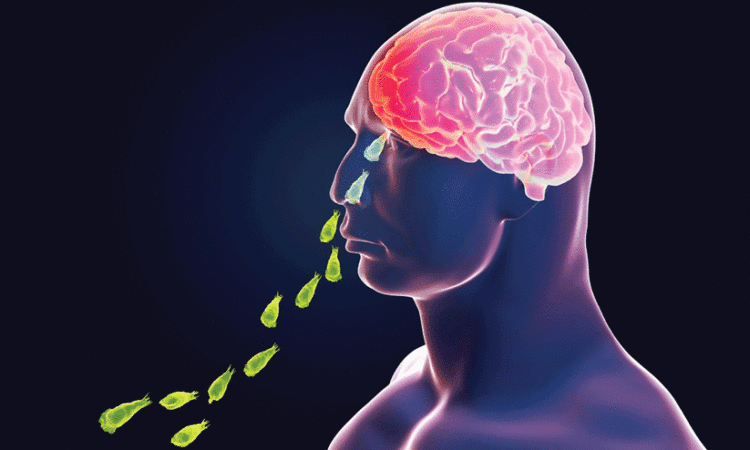 2369422-ameobic-meningo-encephalitis-29824